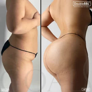 Antes y después de Double BBL 1